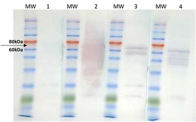 Multi-Epitope Protein as a Tool of Serological Diagnostic Development for HTLV-1 and HTLV-2 Infections